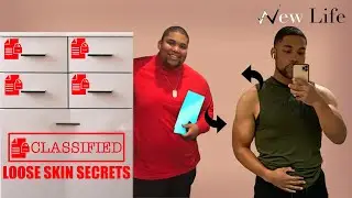 The Truth About Loose Skin Post weight Loss And Tips  On How To Handle It