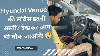 Hyundai Venue की सर्विस इतनी सस्ती? देखकर आप भी चौंक जाओगे! 😲