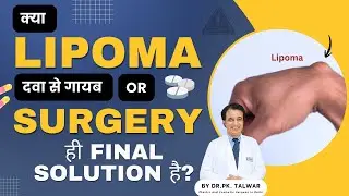 Lipoma: दवा से गायब  या Surgery ही Final Solution है? Must Watch Before Treatment | Dr. P.K Talwar 😲