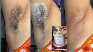 Armpit waxing tutorial/ special Wax for winter season/ #armpitwaxing #Ricamilkwax @pummybeautyworld