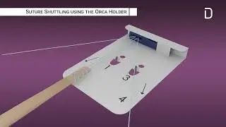 Orca FDL Tendon OPT Animation Crosssection