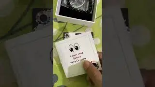 Ultimate protection bracelet unboxing and review | Pyrite | Black magic | Evil eye | Nazar