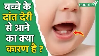 Delay In Tooth Eruption: Sometimes small children's teeth come late.