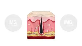 Human skin cross-section with hair follicle growing anatomy cartoon animation