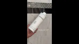 Backne, chestne, and shoulder breakouts happen!
