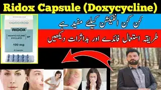 Ridox Capsule uses in Urdu | how to uses ridox Capsule | Doxycycline uses | doxycycline ka estemal 
