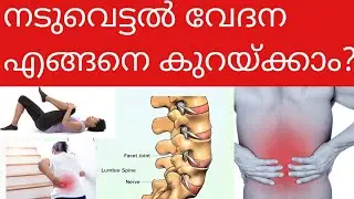 Back Pain Relief |Naduvettal |Acute Locked Back