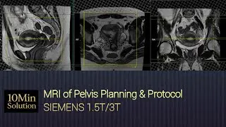 MRI Pelvis Planning Step-by-Step | Complete Tutorial for Beginners