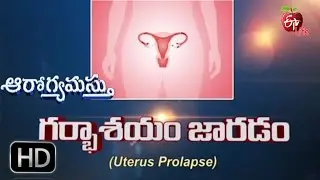 Aarogyamastu | Uterus Prolapse |23rd September 2016 | ఆరోగ్యమస్తు