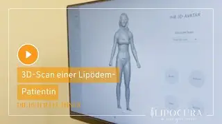 3D-Scan einer Lipödem-Patientin
