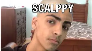 The Legend of Scalppy! (Bald Skeppy)