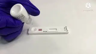 Malaria Rapid Diagnostic Test by Arkray  : ParaHIT f Device