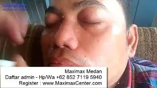 Maximax Medan 