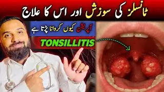 TONSILLITIS treatment | SORE THROAT don&rsquo;t mean TONSILLECTOMY by Dr Mujtaba. 