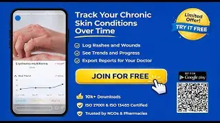 Chronic Skin Condition Tracker | Eczema, Psoriasis, Acne & Rosacea Management #Eczema #Psoriasis
