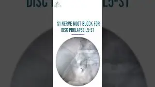 S1 Nerve Root Injection For Disc Prolapse ( L5 -S1) Under Fluoroscopy Guidance.