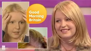 Hair Loss Miracle Makeover on LK Today, UK TV