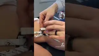 Tweaked Knee Skiing? ⛷️ KT Tape & Recovery at Spine Spot Basalt