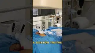 Tail Bone Pain Treatment by minimally invasive surgery. #painrelief #tailbonepain #coccydynia