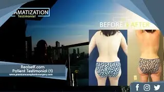 Realself.com Patient Testimonial (1): Mommy Makeover with Dr. Alex Campbell and Premium Care