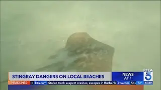 How California beachgoers can prevent and treat stingray stings