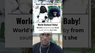 World&rsquo;s Darkest Baby!
