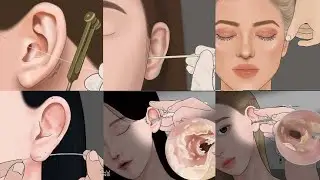 ASMR Satisfying Ear Cleaning Therapy Animation | ASMR Blackhead Removal Animation @bloombrainasmr