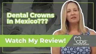 Why Get Dental Crowns in Mexico? | Cancun Dental Specialists Review