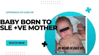 Neonatal Lupus Erythematous|Approach to baby born to SLE+ve mother #paediatrics #lupus #neet #fmge