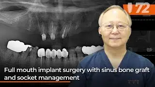 Dr. Park's Live Surgery 72nd Preview
