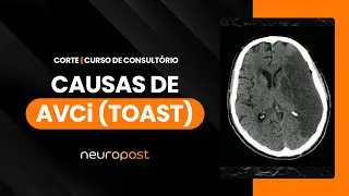 Classificando as Causas de AVC isquêmico: SSS-TOAST