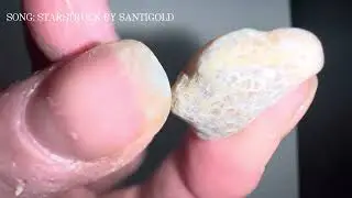 ALL THE UGLY ROCKS I FIND IN THE WOODS