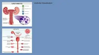 Urethritis Explained Causes, Symptoms and Treatment, All Insights