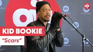 Kid Bookie - Scars (Live sur O&Uuml;I FM)