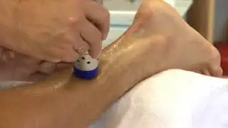 treatment of Achillodynia with shockwave therapy