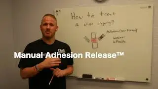Diagnosed With A Disc Injury? Watch This