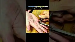 #cuttingring #ring #painless #tech #knowledge #technology #history #usa #innovation #viral #shorts