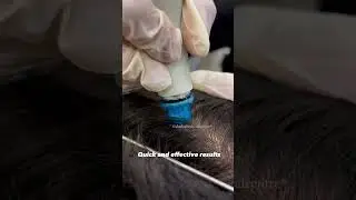 Maintain Hair Health With Keravive Hydrafacial #keravive #haircare #shorts