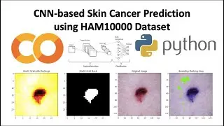 Skin Cancer Prediction using HAM10000 Dataset CNN-based EfficientNetB0