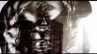 The Truth About Steriods & Synthol - Steroid Documentary