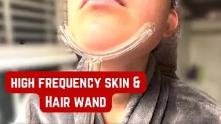 NuDerma Clinical Skin Therapy Wand - Portable Skin Therapy Machine w 6 Wands