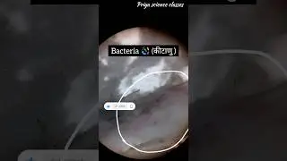 Colgate ko microscope se dekhne pr kesa dikhta hai 😱🔬🤯 #viral #trending #trending #experiment #video