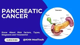 Understanding Pancreatic Cancer: Types, Risk Factors, Global Incidence, Diagnosis, and Treatment