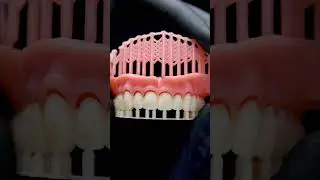 SprintRay Denture Base and Teeth Launch Vertical