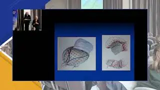 The Brain Doctor - Epilepsy Ireland National Conference 2025
