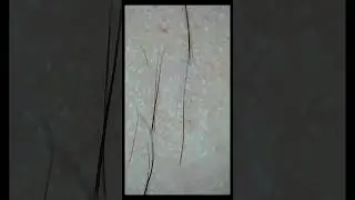 Gently Tweeze & Pluck Hairs on the Arm | 50x Zoom Close-Up #Shorts
