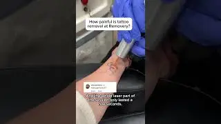 How painful is tattoo removal at Removery?🧐
