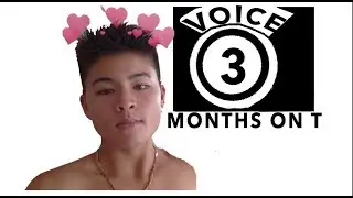 VOICE PROGRESSION: 3 MONTHS ON TESTOSTERONE
