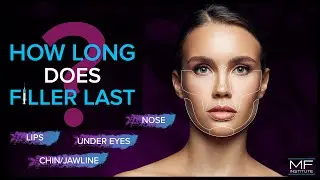 The Facts About Filler Longevity By Area | Mabrie Facial Institute in San Francisco