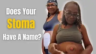 Why Some People Name Their Stoma and What Makes Sense